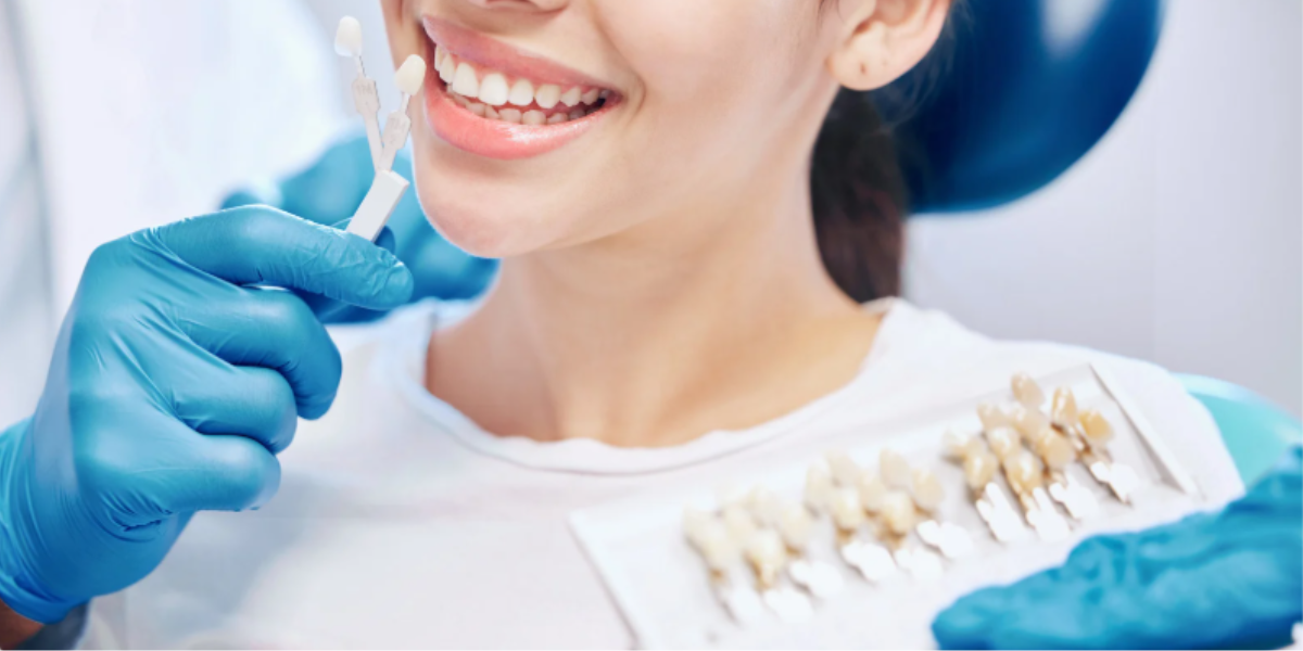 what-are-dental-crowns-and-bridges-guide