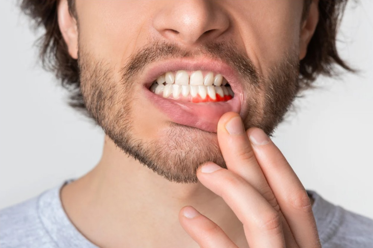 How to relieve tooth infection pain?