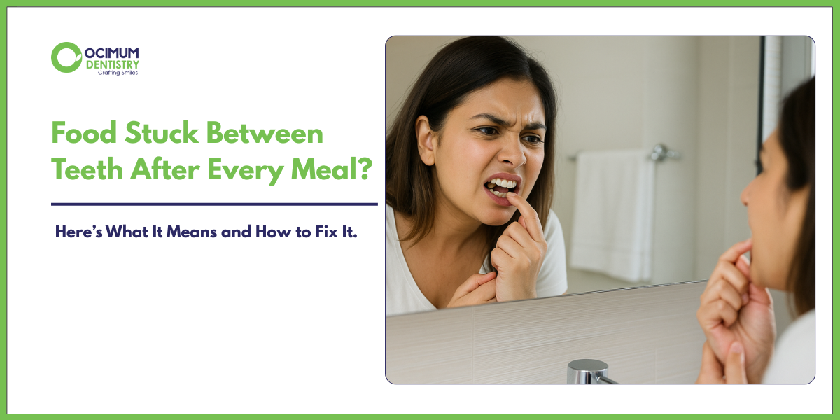 Food stuck between teeth after every meal?
