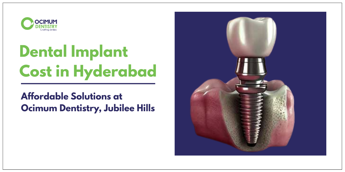 Dental Implant Cost in Hyderabad: Affordable Solutions at Ocimum Dentistry, Jubilee Hills