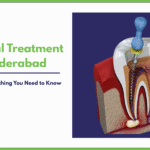 Root Canal Treatment Cost in Hyderabad | Ocimum Dentistry, Jubilee Hills