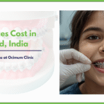 Teeth Braces Cost in Hyderabad, India | Types, Benefits & Prices at Ocimum Clinic