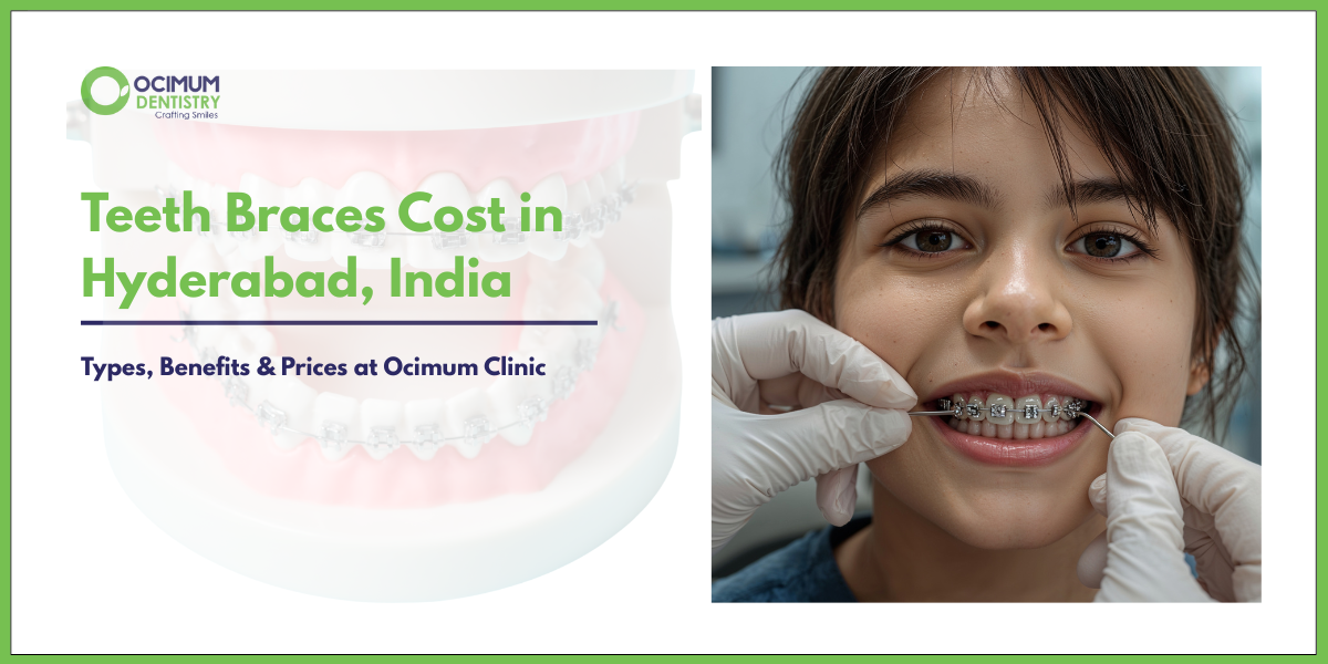 Teeth Braces Cost in Hyderabad, India | Types, Benefits & Prices at Ocimum Clinic