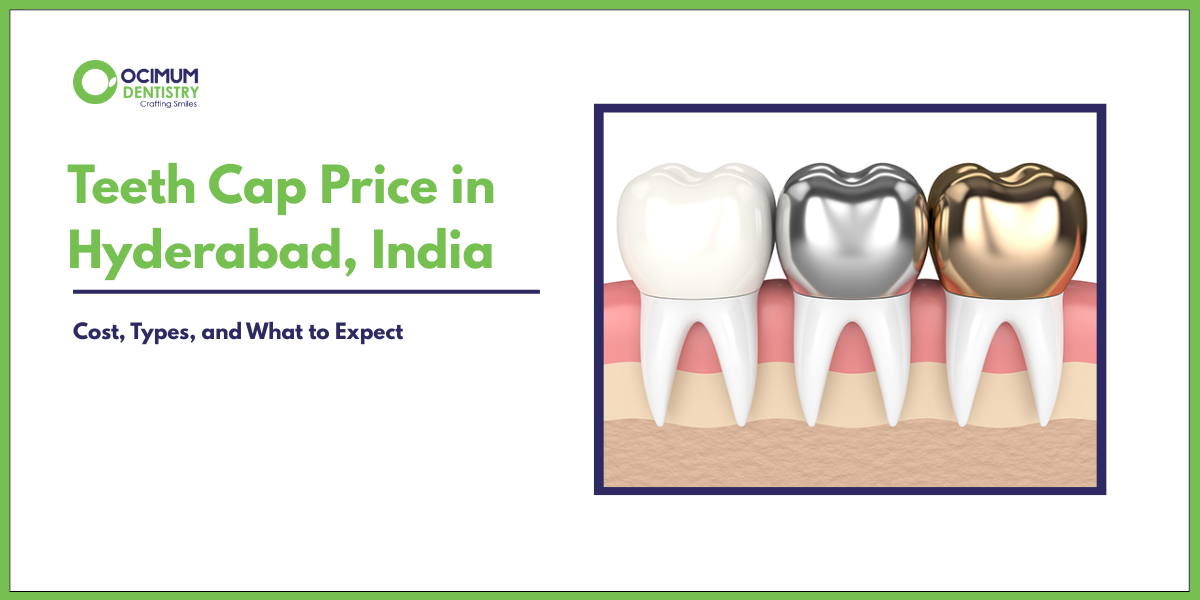 Teeth Cap Price in Hyderabad | Cost, Types & Best Dental Options