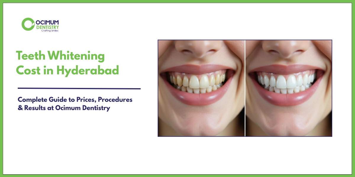 Teeth Whitening Cost in Hyderabad: Price, Laser Treatment & Best Clinic